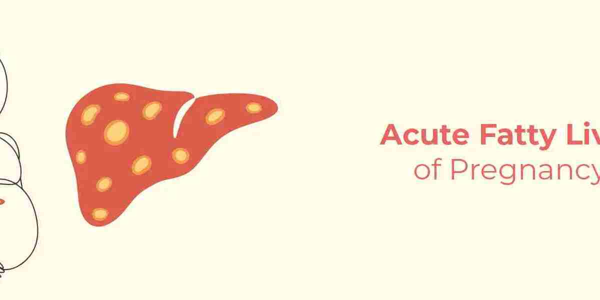 Acute Fatty Liver Of Pregnancy: Symptoms Every Pregnant Woman Should Know